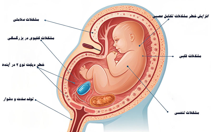 پیشگیری از دیابت نوع دو