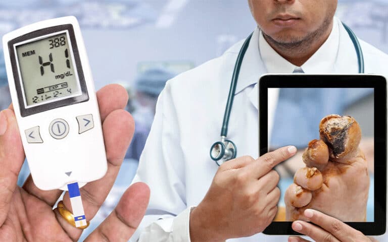 تفاوت زخم دیابتی و زخم عادی چیست؟