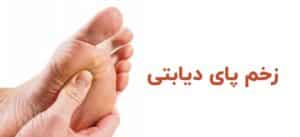 زخم پای دیابتی