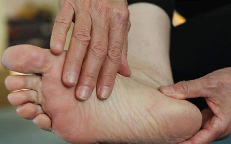 درمان خانگی زخم پای دیابتی