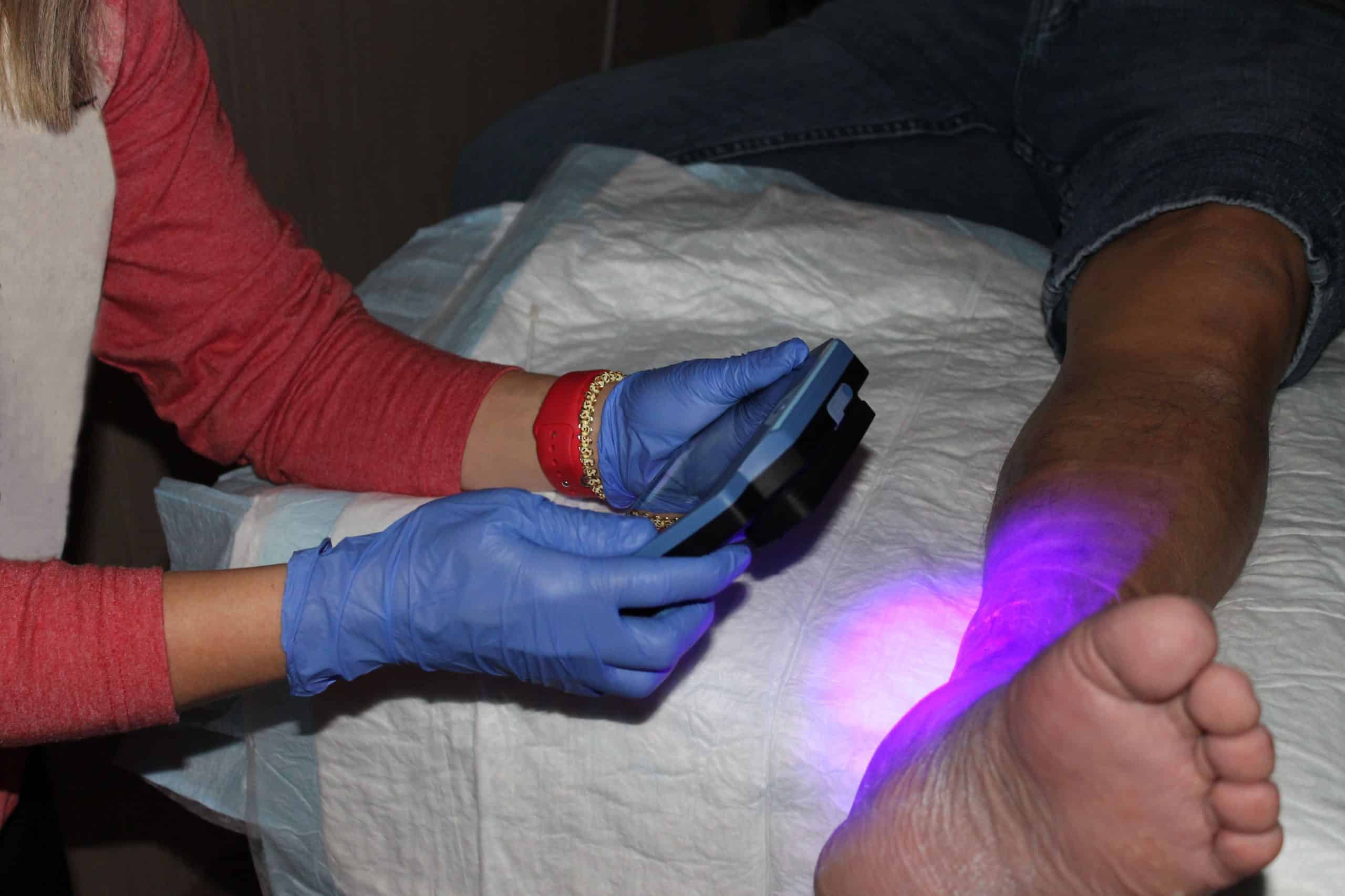 خدمات لیزر نور آبی