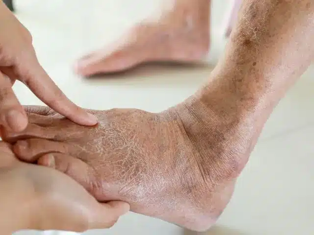 کلینیک تخصصی زخم