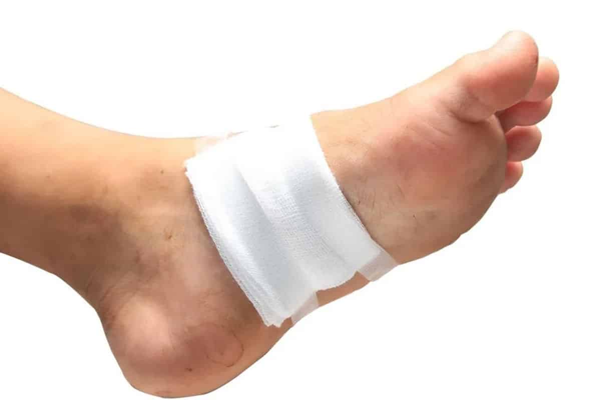 روش درمان زخم دیابتی