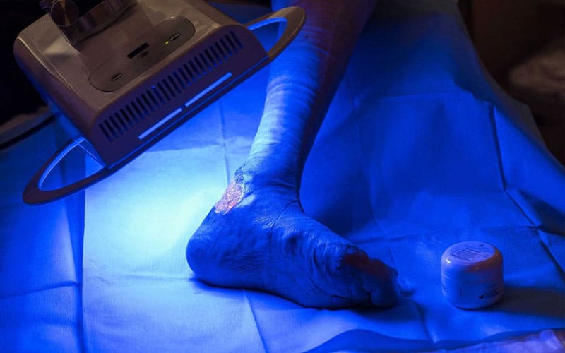 تفاوت لیزر نور آبی با لیزر نور سبز