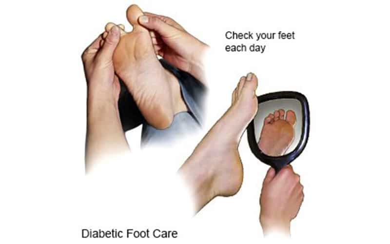 مراقبتهای روزانه از پا دیابتی