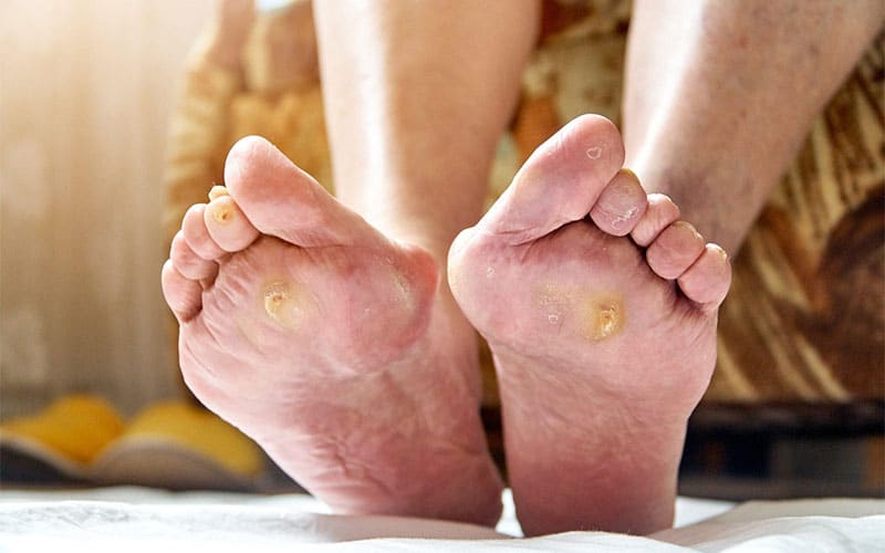 معجزه 1404 | درمان زخم دیابت