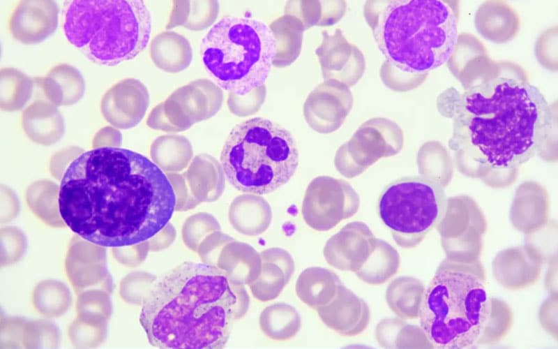 ناکارآمدی سلول های دفاعی