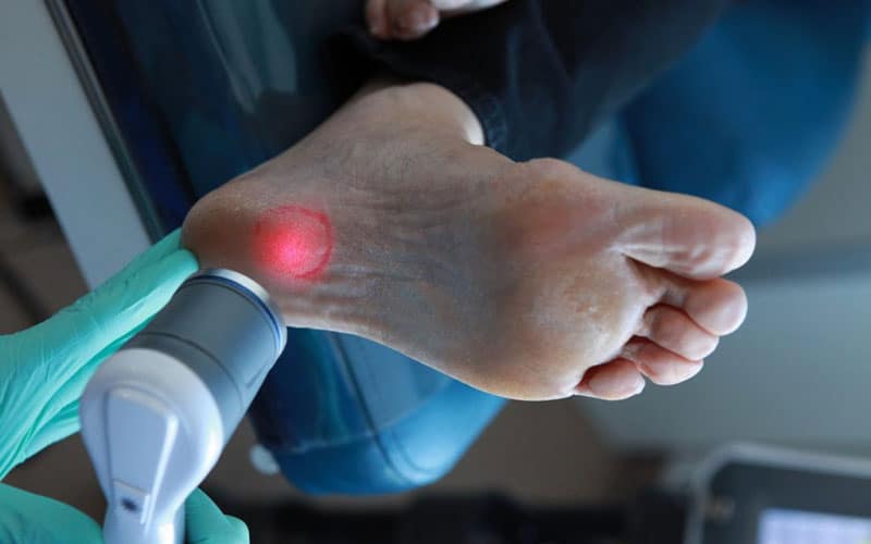 نقش لیزر تراپی در درمان زخم پای دیابتی