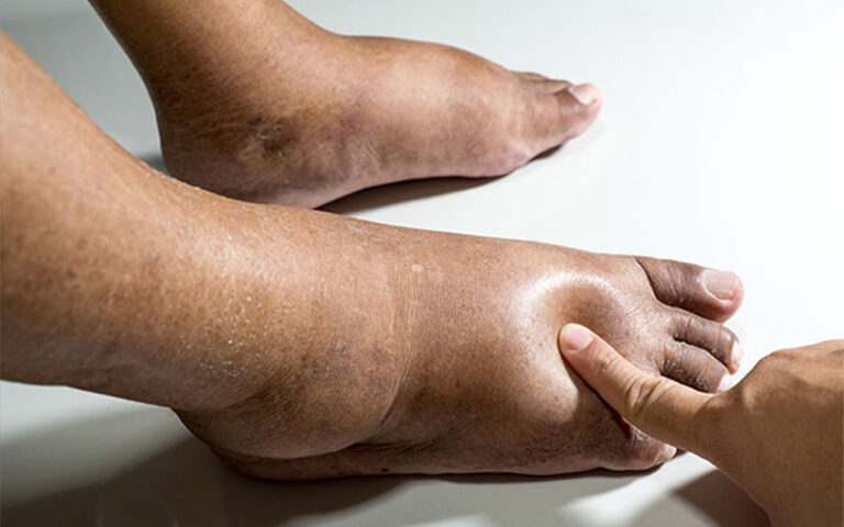 آیا بی‌حسی پا نشانه خطر است؟